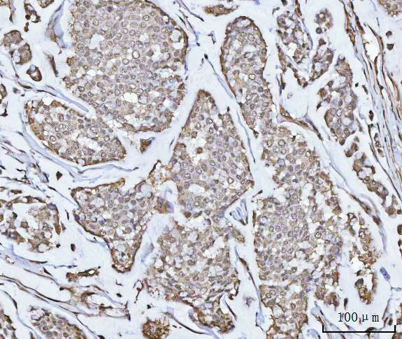  IHC analysis of PPM1G using anti-PPM1G antibody (A06725-2)