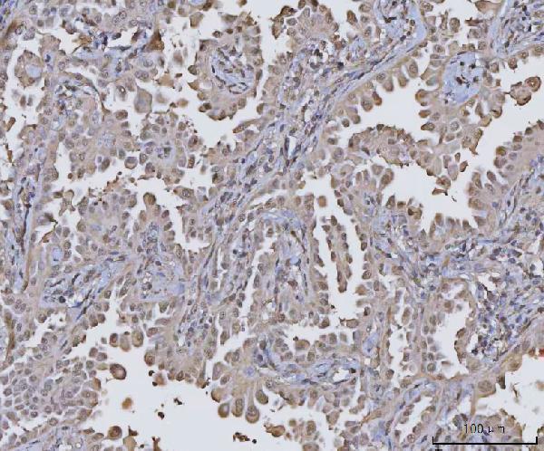  IHC analysis of PPM1G using anti-PPM1G antibody (A06725-2)
