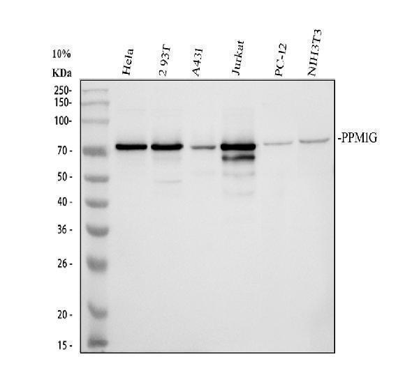  Western blot analysis of PPM1G using anti-PPM1G antibody (A06725-2)