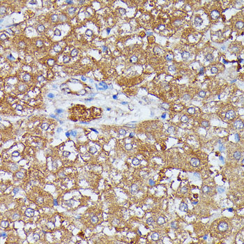 Immunohistochemistry of paraffin-embedded rat liver using HDLBP antibody  at dilution of 1:100 