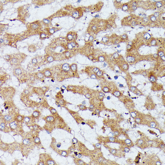 Immunohistochemistry of paraffin-embedded human liver using HDLBP antibody  at dilution of 1:100 