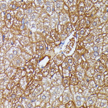 a06727 hdlbp primary antiboties ihc testing 4