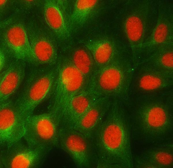  IF analysis of RBMY1A1 and Tubulin beta using anti-RBMY1A1 antibody (A06728-1) and anti-Tubulin beta antibody (M05613-4)