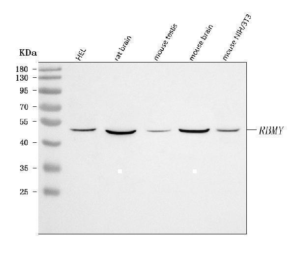  Western blot analysis of RBMY1A1 using anti-RBMY1A1 antibody (A06728-1)