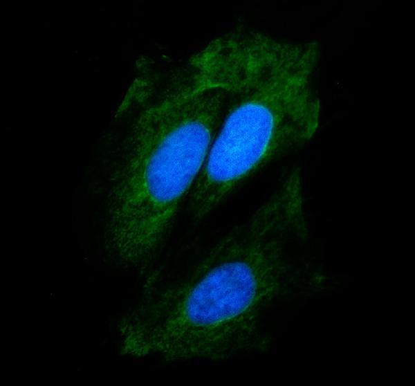 IF analysis of SPRR3 using anti-SPRR3 antibody (A06729-2)