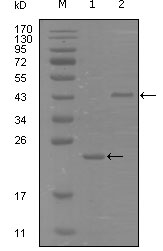 Western Blot analysis using EphA8 Monoclonal Antibody against truncated Trx-EphA8 recombinant protein (1) and truncated MBP-EphA8 (aa70-150) recombinant protein (2)