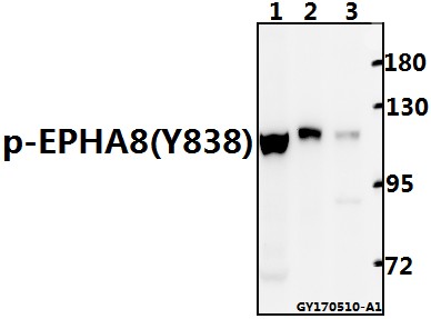 Western blot (WB) analysis of EPHA8 (phospho-Y838)  polyclonal antibody at 1:500 dilution
Lane1:Hela whole cell lysate(40ug)
Lane2:The Spleen tissue lysate of Mouse(40ug)
Lane3:The Kidney tissue lysate of Rat(40ug)