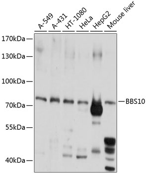 a06733 bbs10 primary antiboties wb testing 1
