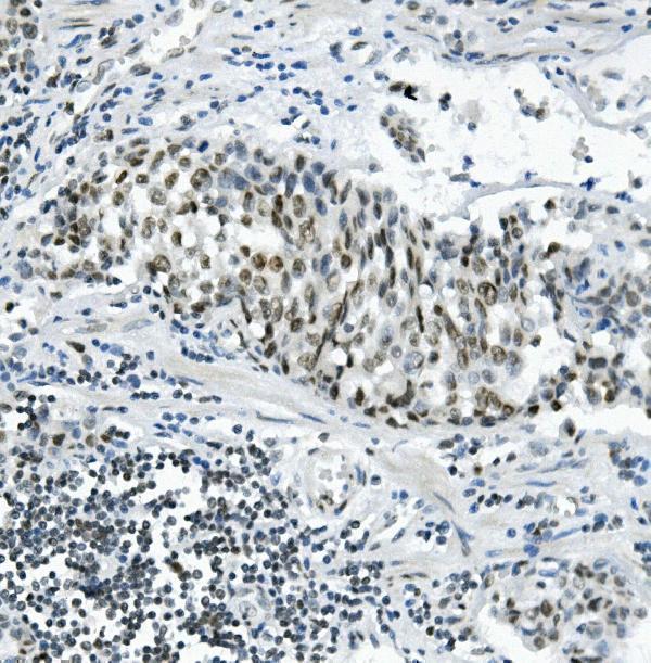 a06736 1 prdm5 primary antibodies ihc testing 2