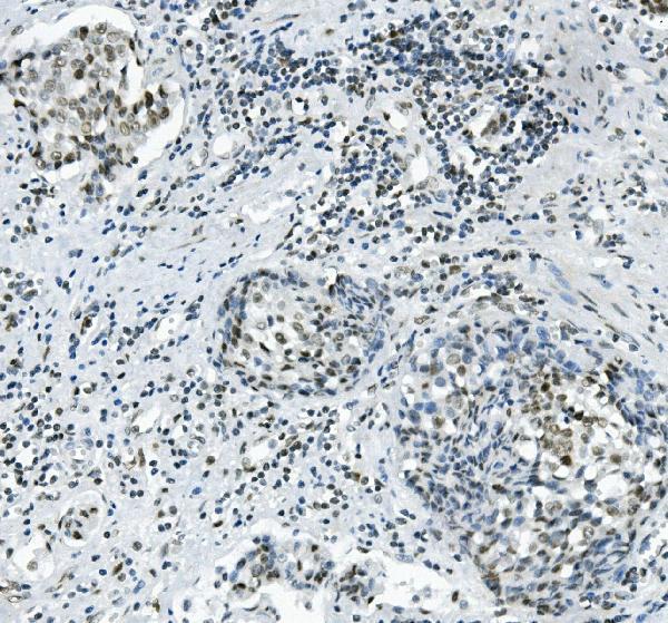 a06736 1 prdm5 primary antibodies ihc testing 3