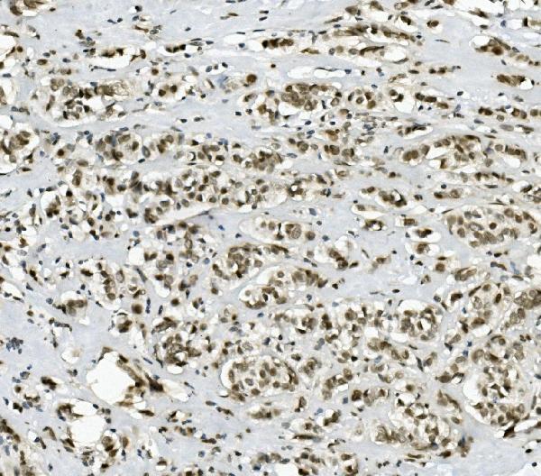 a06736 1 prdm5 primary antibodies ihc testing 4