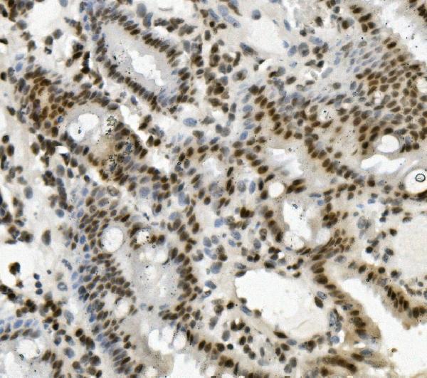 a06736 1 prdm5 primary antibodies ihc testing 5