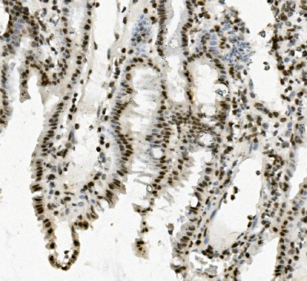 a06736 1 prdm5 primary antibodies ihc testing 6