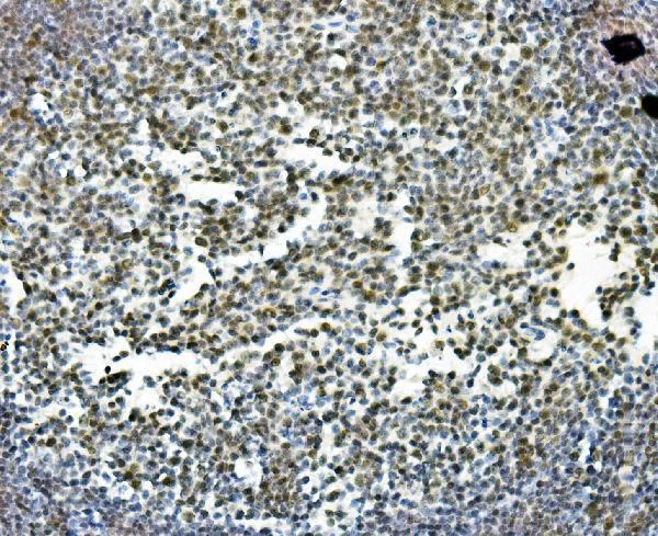 a06736 1 prdm5 primary antibodies ihc testing 7