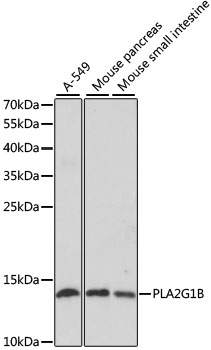 Western blot analysis of extracts of various cell lines, using PLA2G1B antibody  at 1:1000 dilution