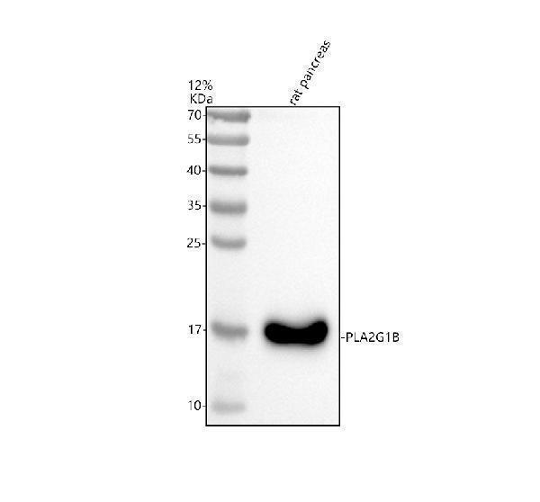 Western blot analysis of PLA2G1B using anti-PLA2G1B antibody (A06738-2)
