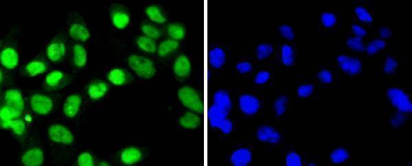 ICC staining SUMO4 in 293 cells (green)
