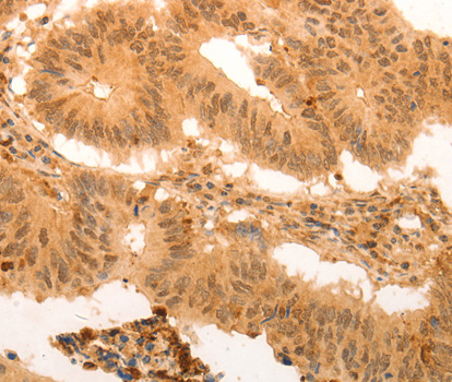 Immunohistochemistry (IHC) analysis of SUMO4 polyclonal antibody