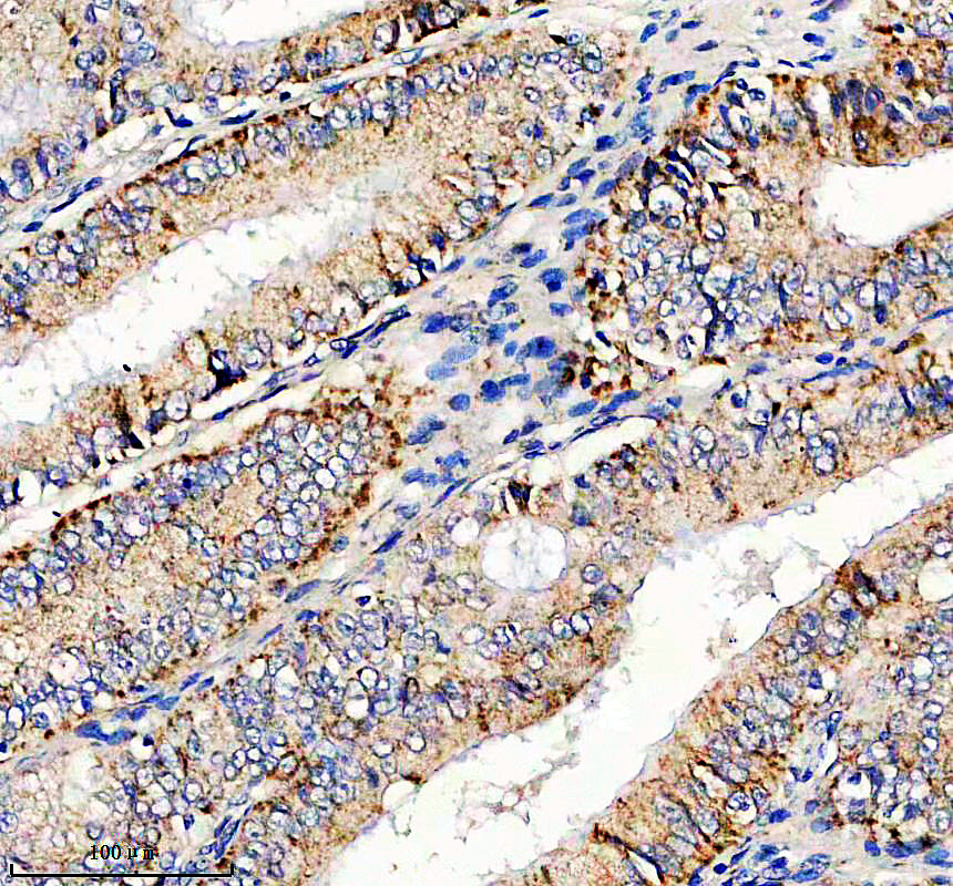 IHC analysis of ITGB8 using anti-ITGB8 antibody (A06744-1)