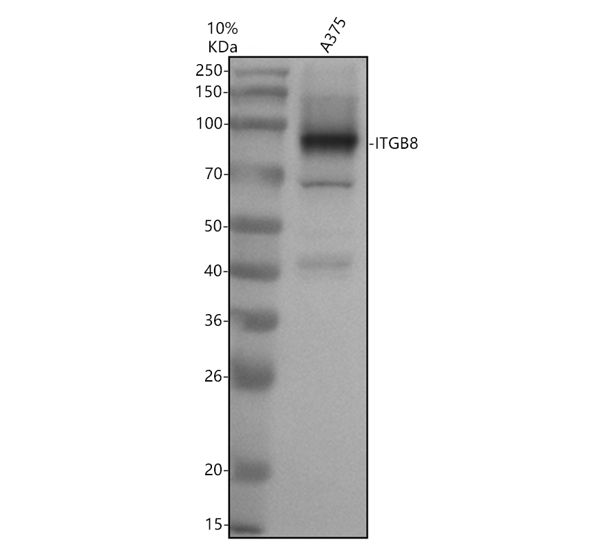 Western blot analysis of ITGB8 using anti-ITGB8 antibody (A06744-1)