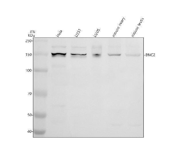 Western blot analysis of BNC2 using anti-BNC2 antibody (A06745-1)