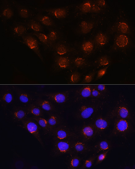 Immunofluorescence analysis of C6 cells using GOLGA4 Rabbit pAb  at dilution of 1:100 