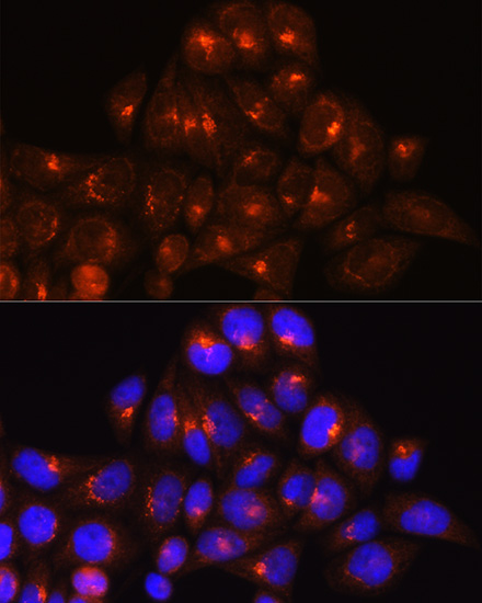 Immunofluorescence analysis of HeLa cells using GOLGA4 Rabbit pAb  at dilution of 1:100 