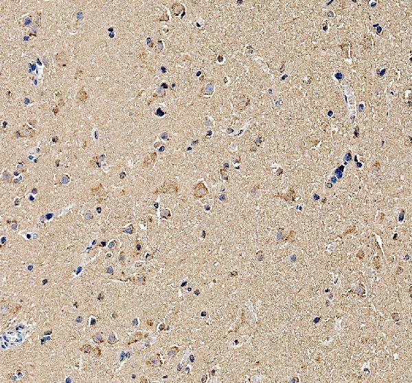 a06754 3 gnb5 primary antibodies ihc testing 1