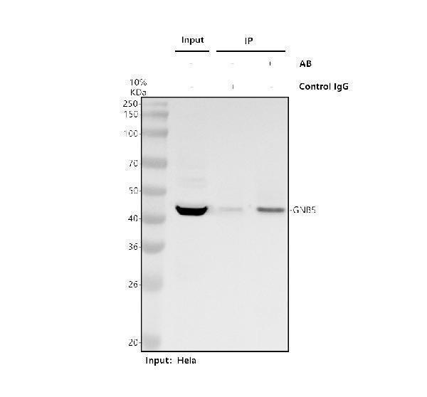 a06754 3 gnb5 primary antibodies ip testing 1