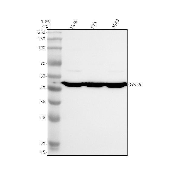 Anti-GNB5 Antibody Picoband&reg;