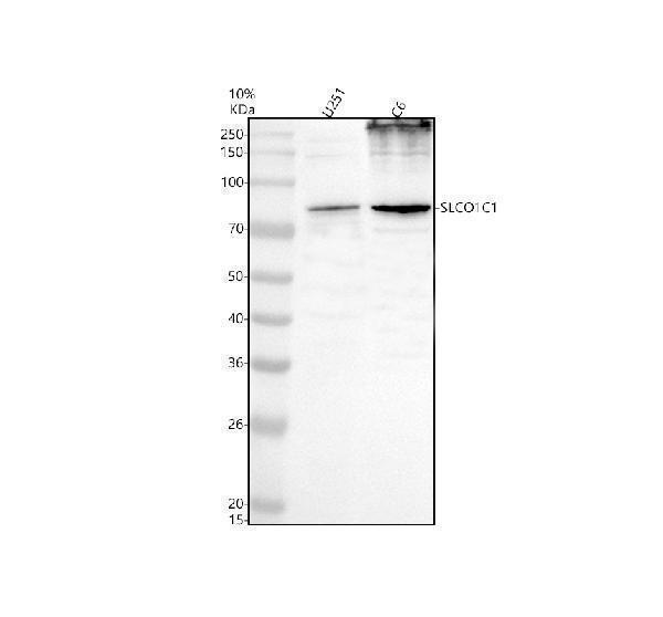 Western blot analysis of SLCO1C1 using anti-SLCO1C1 antibody (A06757-1)