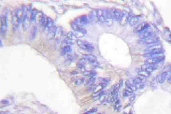 a06762s855 lipe primary antiboties ihc testing 2