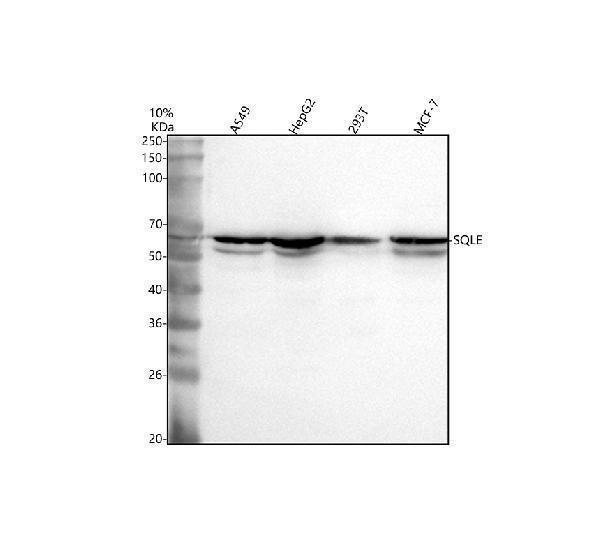  Western blot analysis of SQLE using anti-SQLE antibody (A06763-1)
