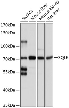 Western blot analysis of HepG2, using SQLE antibody  at 1:1940 dilution