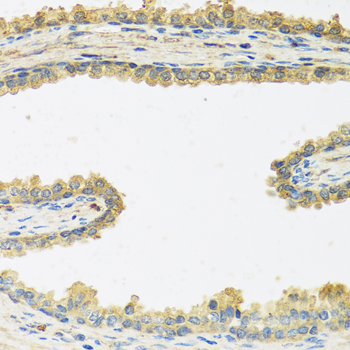 a06764 crhbp primary antiboties ihc testing 2