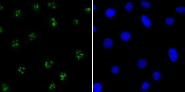 ICC staining CENPC in SH-SY-5Y cells (green)