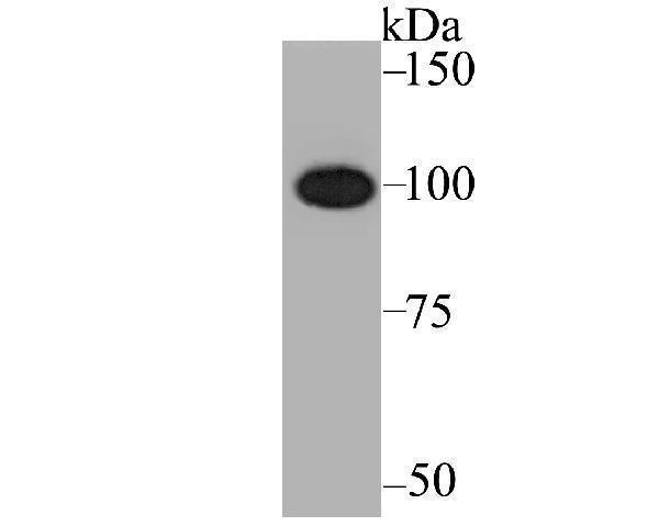 Western blot analysis of CENPC on K562 cell lysate using anti-CENPC antibody at 1/1,000 dilution