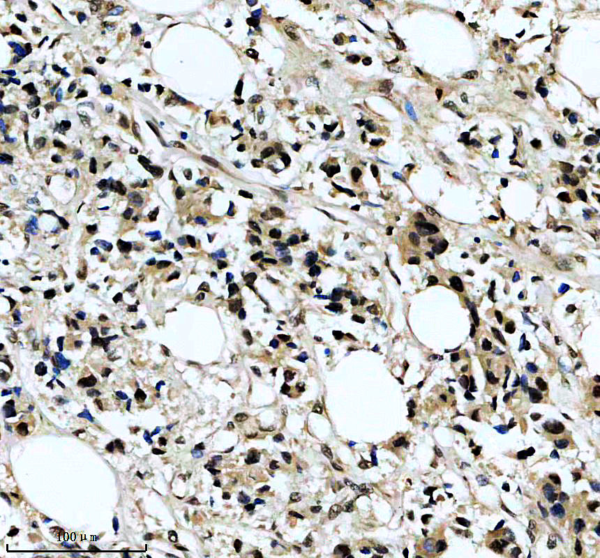 IHC analysis of MACROD1 using anti-MACROD1 antibody (A06767-1)