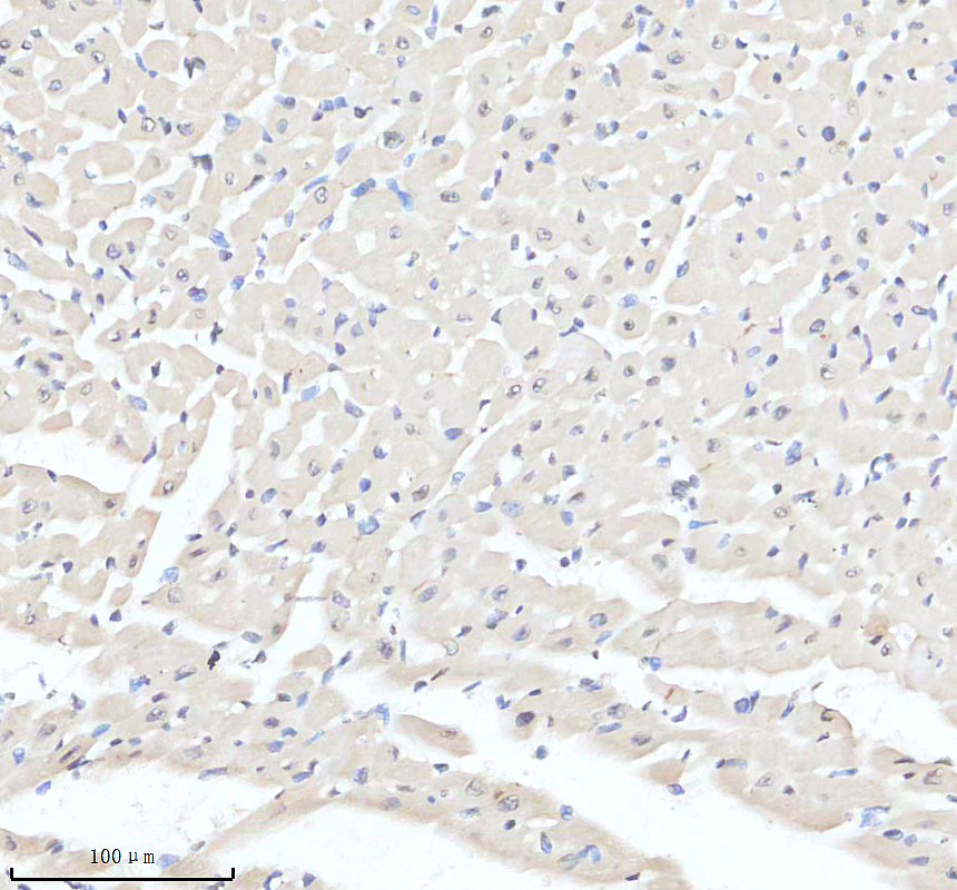 IHC analysis of MACROD1 using anti-MACROD1 antibody (A06767-1)