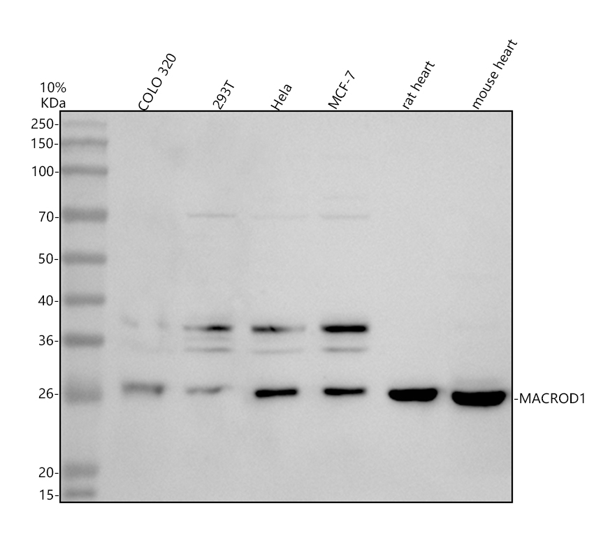 Western blot analysis of MACROD1 using anti-MACROD1 antibody (A06767-1)