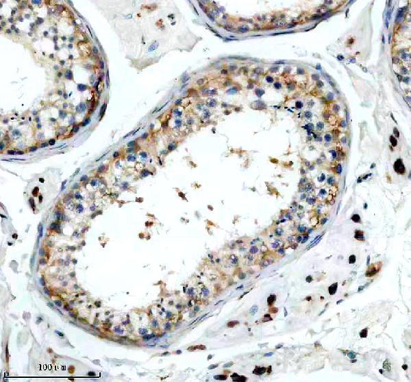 a06768 3 slc15a4 primary antibodies ihc testing 1