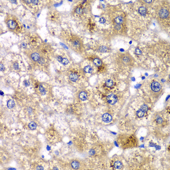 Immunohistochemistry of paraffin-embedded human liver injury using AMY2A antibody at dilution of 1:100 (x40 lens)
