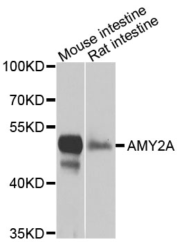 Western blot analysis of extracts of various cells, using AMY2A antibody