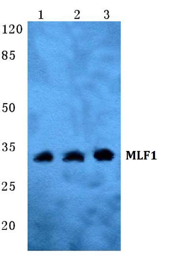 Western blot (WB) analysis of MLF1 polyclonal antibody at 1:500 dilution
Lane1:Hela cell lysate
Lane2:sp2/0 cell lysate
Lane3:H9C2 cell lysate