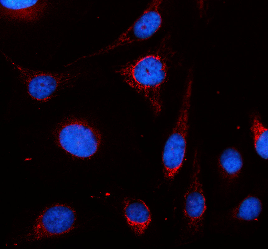IF analysis of PLOD3 using anti-PLOD3 antibody (A06773-1)