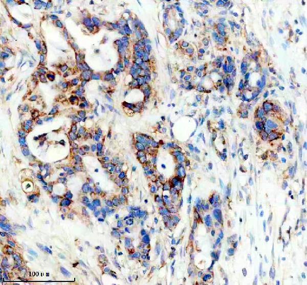 IHC analysis of PLOD3 using anti-PLOD3 antibody (A06773-1)