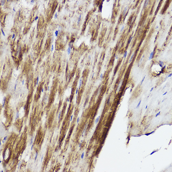 Immunohistochemistry of paraffin-embedded mouse heart using PLOD3 Rabbit pAb  at dilution of 1:50 
