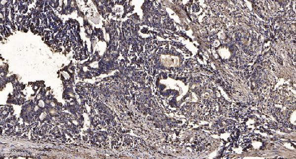 a06774 stk38l primary antibodies ihc testing 1