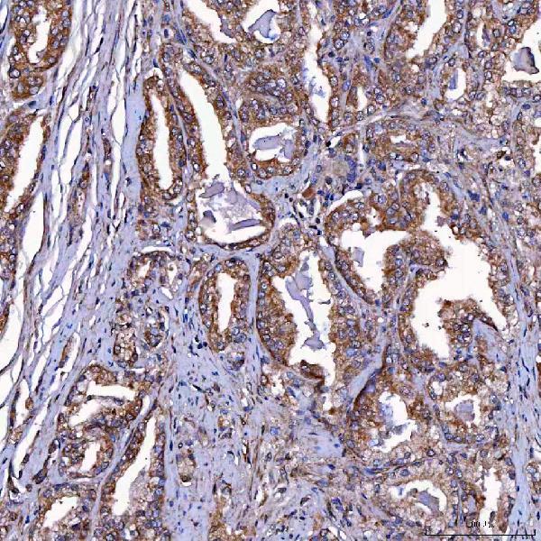  IHC analysis of TOMM34 using anti-TOMM34 antibody (A06775-1)
