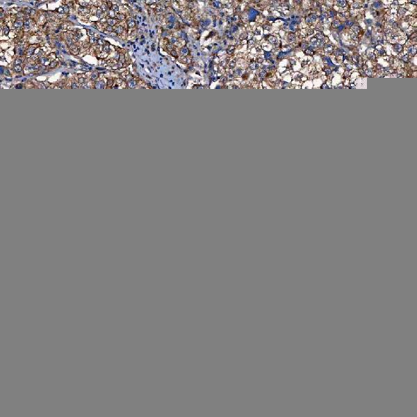  IHC analysis of TOMM34 using anti-TOMM34 antibody (A06775-1)